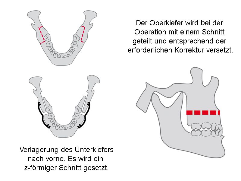 Ablauf der Behandlung - Kieferorthopädie Dortmund, Dr. Katrin Wolff